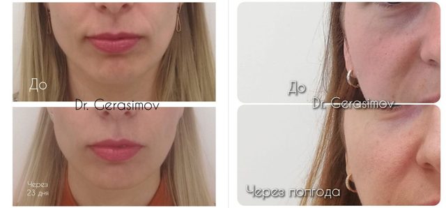 Улучшить качество кожи: работа врача, снимок 1 из 1